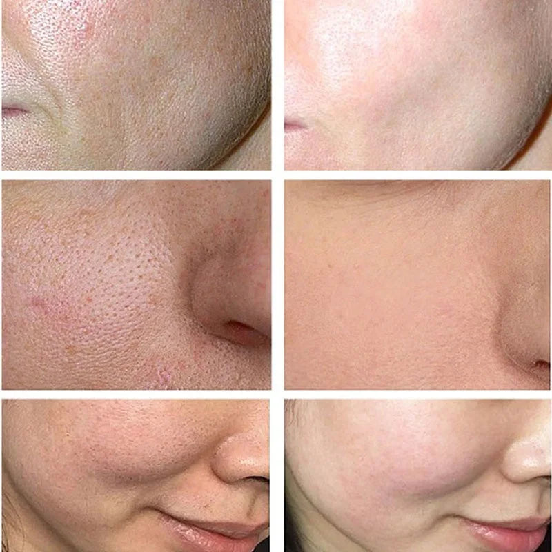 Pore Shrinking Face Serum Purifying Large Pores Skin Care