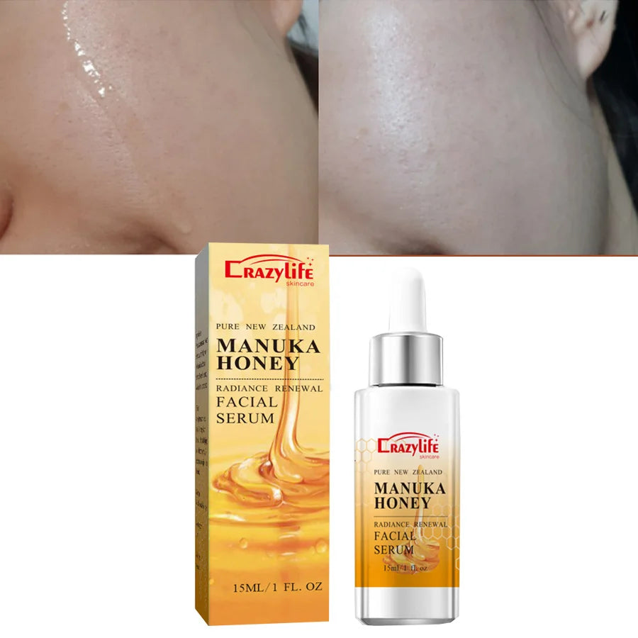 Manuka Honey Gold Face Serum Moisturizing Anti-Wrinkle Essence