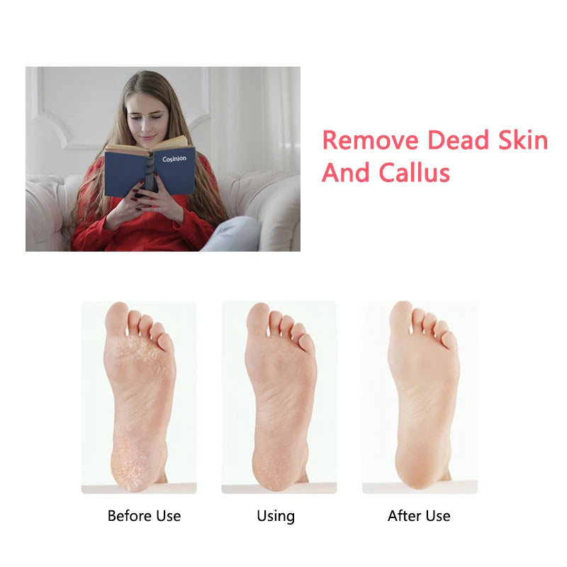 Electric Rechargeable Pedicure Tools Remove Dead Skin Callus Remover