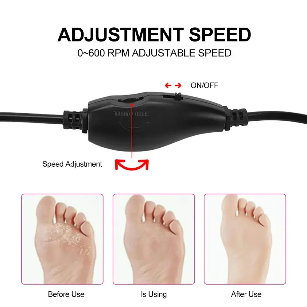 Electric Foot Callus Remover Foot Care File Heels Dead Skin