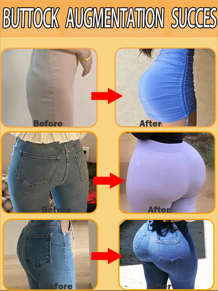 Increase Buttocks Cream for Natural Curves and Shape