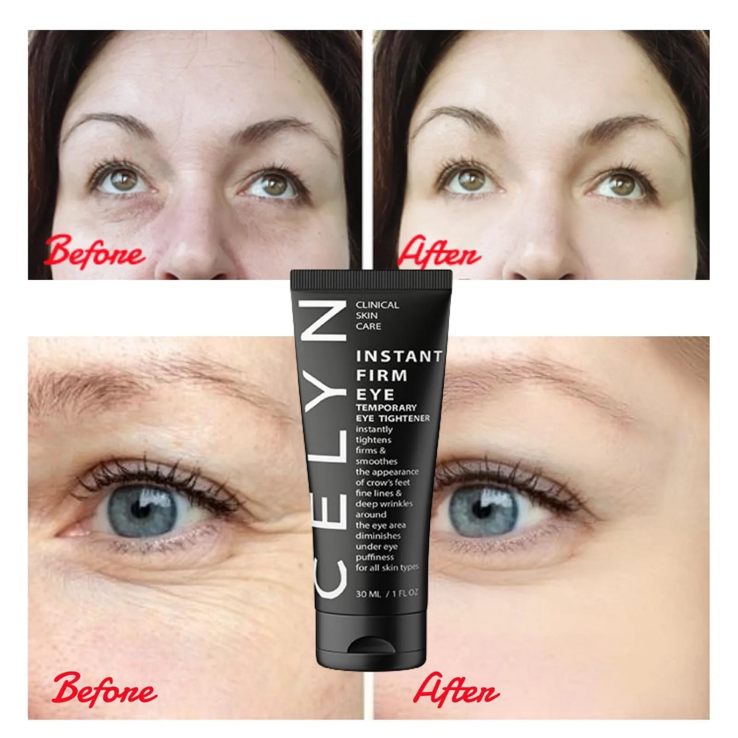 Instant Firm Eye Tightener to Diminish Eye Bags and Lines