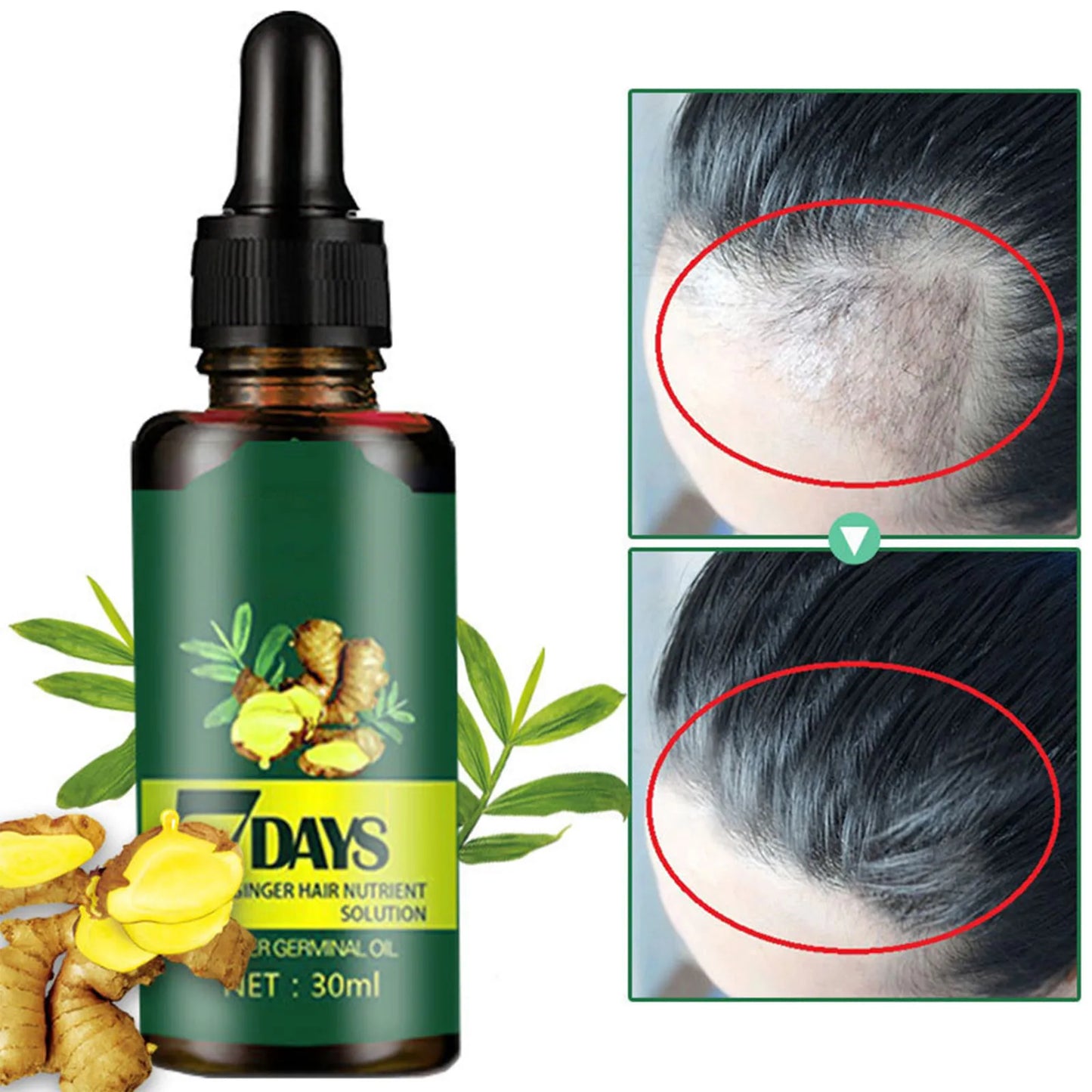 Hair Growth Hair Plant Care Oil for Dense Hair 30ML