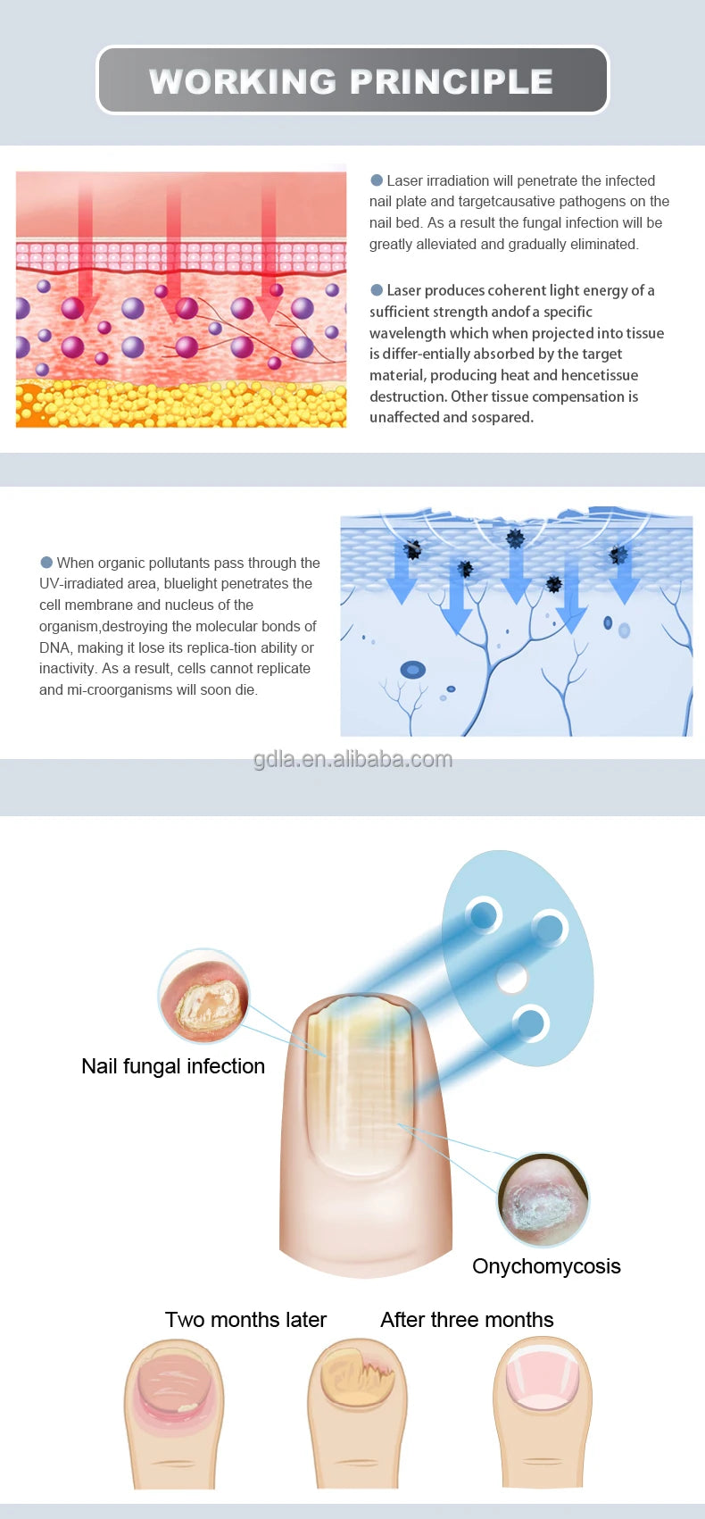 Low Level Cold Laser Toenail Fungus Therapy Device for Healing