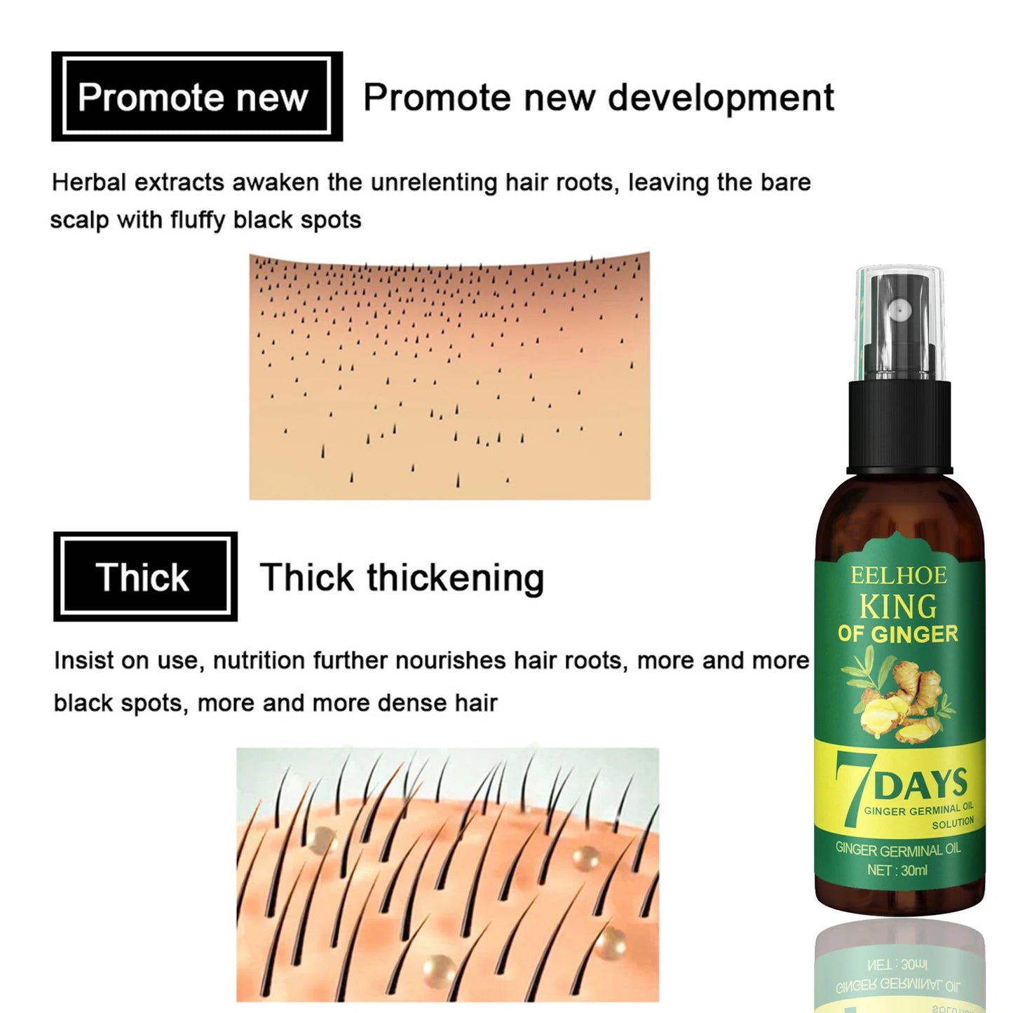 Ginger Hair Growth Serum Sprayer for Thicker Hair Growth