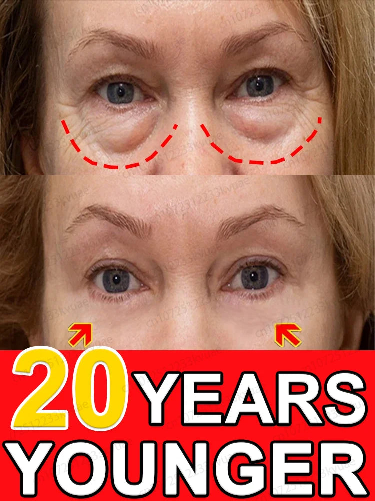 7 Days to Make You 20 Years Younger Eye Cream