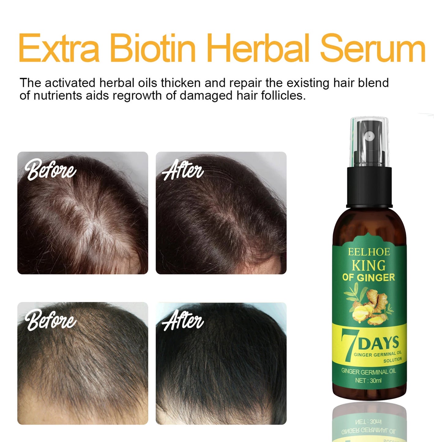 Ginger Hair Growth Serum Sprayer for Thicker Hair Growth