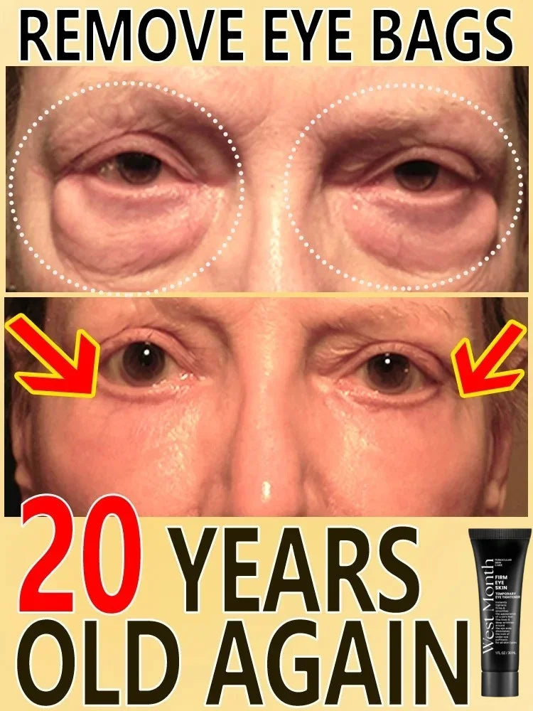 West&Month Eye Cream Removes Dark Circles And Firms Eyes