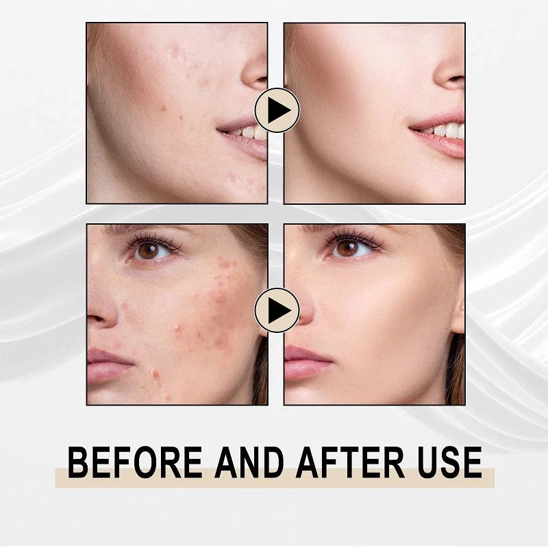 Pore Shrinking Face Serum Purifying Large Pores Skin Care